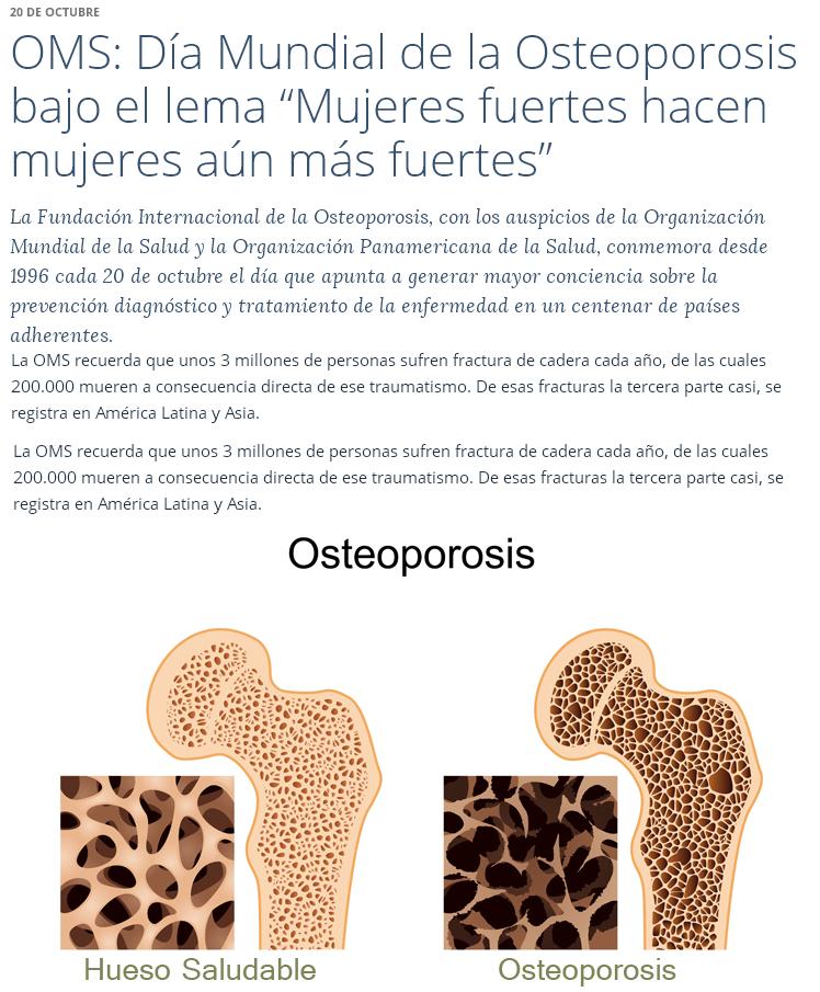 banner osteoporosis